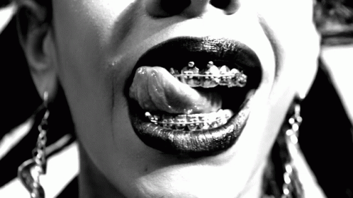 A Close Up Of A Woman 'S Mouth With Braces On Her Teeth GIF
