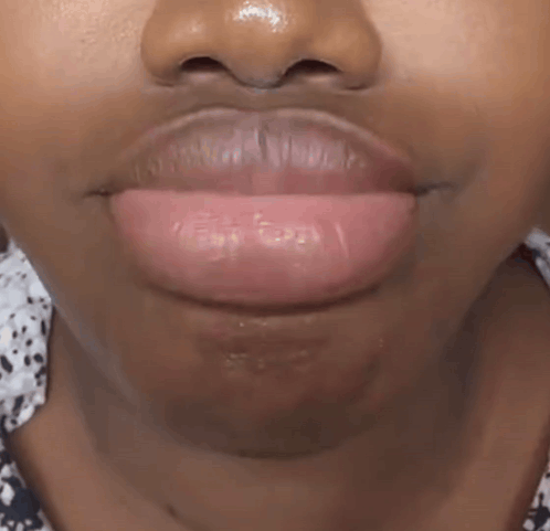 A Close Up Of A Woman 'S Mouth With Her Teeth Showing GIF