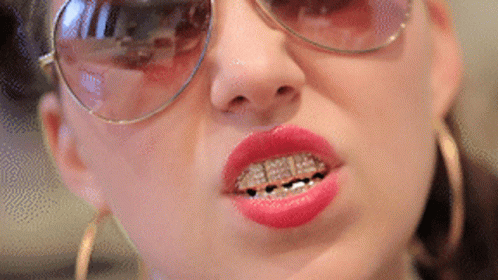 A Close Up Of A Woman Wearing Sunglasses And Braces GIF