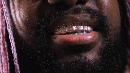A Closeup Of A Man 'S Mouth With Braces On His Teeth GIF