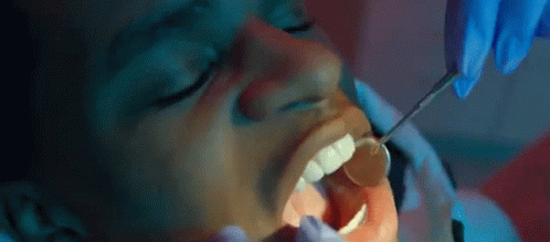 A Dentist Is Examining A Patient 'S Teeth With A Mirror . GIF