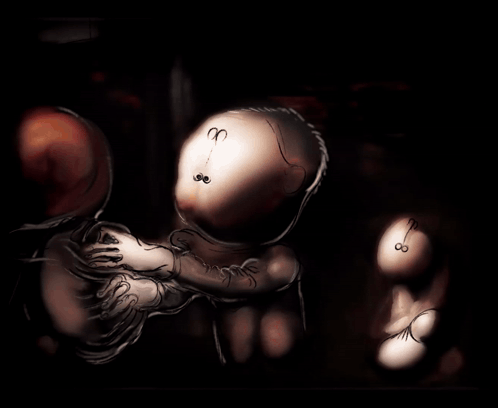 A Drawing Of A Person 'S Heart With A Clock On It GIF