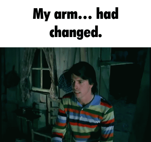 A Man In A Colorful Striped Shirt Says " My Arm ... Had Changed " GIF