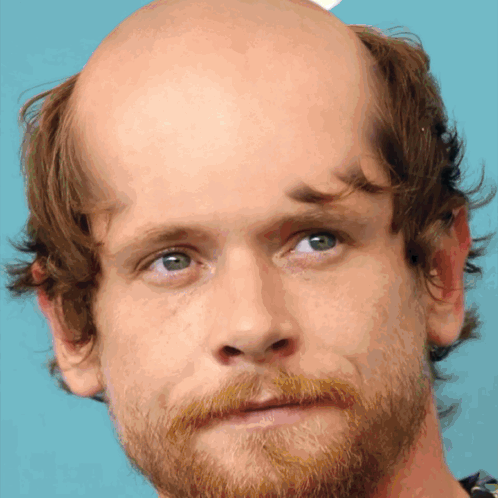 A Man With A Bald Head And A Beard Looks At The Camera GIF