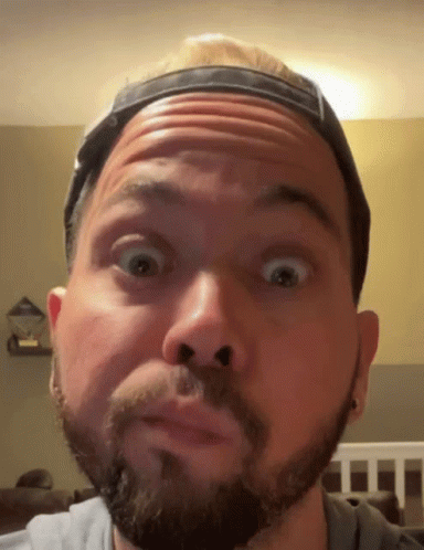 A Man With A Beard Is Making A Funny Face With His Eyes Wide Open GIF