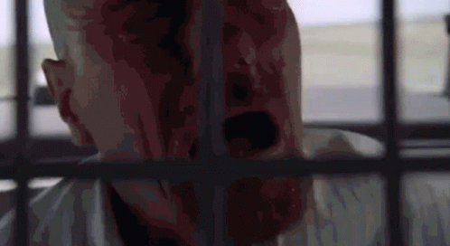 A Man With Blood On His Face Is Behind Bars In A Cell . GIF