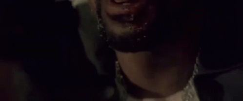 A Man With Blood On His Face Says You Do N't Deserve This . GIF