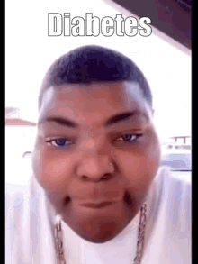 A Man With Diabetes Is Making A Funny Face While Wearing A White Shirt And A Chain . GIF