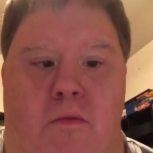 A Man With Down Syndrome Is Making A Funny Face With His Eyes Closed And His Mouth Open . GIF