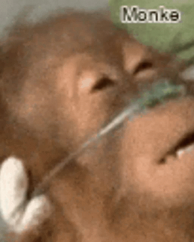 A Monkey With An Oxygen Mask On Its Face Is Laying Down . GIF