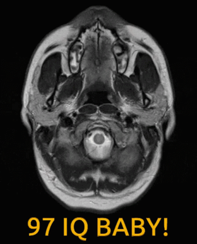 A Mri Scan Of A Baby 'S Head With The Words 97 Iq Baby Below It GIF