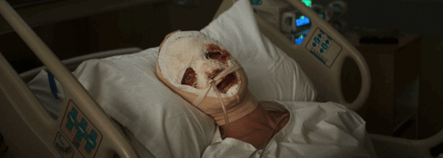 A Person In A Hospital Bed With A Bandaged Face GIF