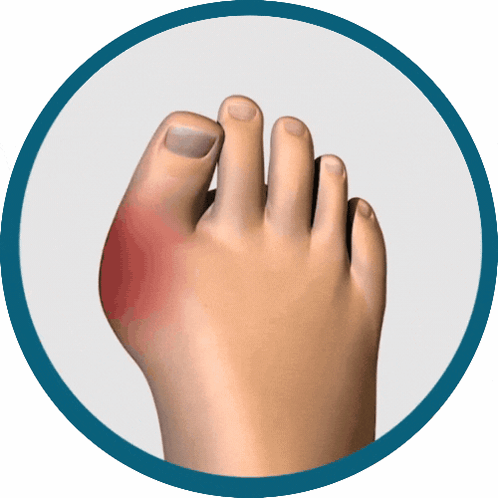 A Person 'S Foot With A Red Spot On The Toe GIF