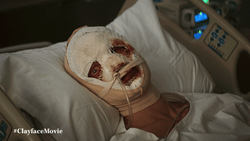 A Person With A Bandage On Their Face Is Laying In A Hospital Bed With The Hashtag #Clayfacemovie GIF