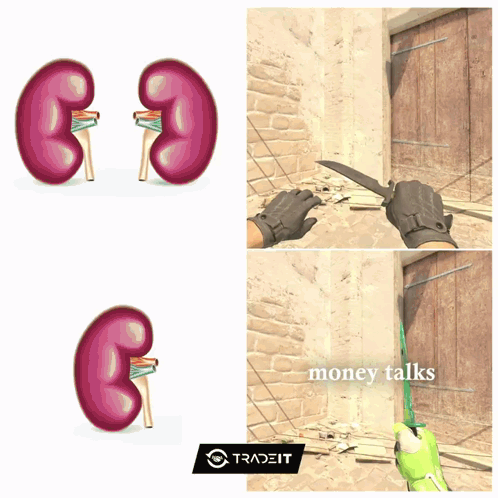 A Picture Of Kidneys And A Picture Of A Person Cutting A Piece Of Wood GIF