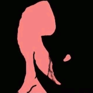 A Pink Silhouette Of A Person 'S Leg Is Against A Black Background . GIF