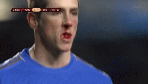 A Soccer Player Has A Bloody Nose During A Game Between Chil And Ste GIF