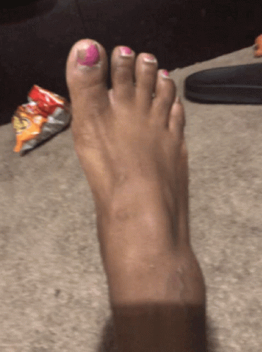 A Woman 'S Foot With Pink Nail Polish On The Toe GIF