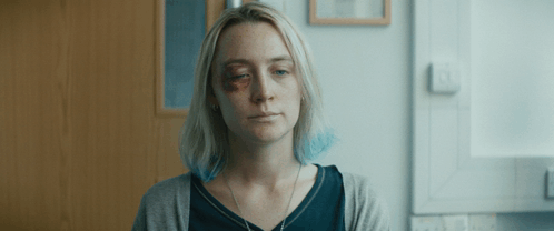 A Woman With A Black Eye And A Necklace On Her Neck GIF