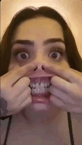 A Woman With Braces On Her Teeth Is Making A Funny Face With Her Hands . GIF
