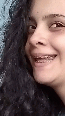 A Woman With Braces On Her Teeth Is Smiling For The Camera GIF