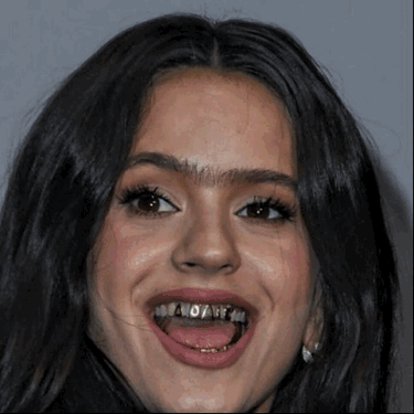 A Woman With Braces On Her Teeth Is Smiling With Her Mouth Open GIF
