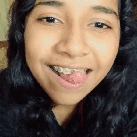 A Woman With Braces On Her Teeth Is Sticking Her Tongue Out GIF