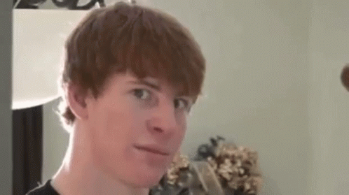 a young man with red hair is making a funny face while looking at the camera .