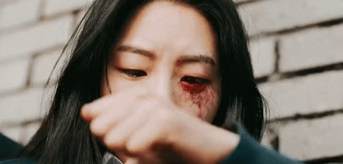 All Of Us Are Dead Half Zombie Nam-ra GIF