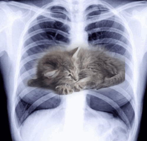 An X-Ray Of A Person 'S Chest With A Kitten Sleeping In It GIF