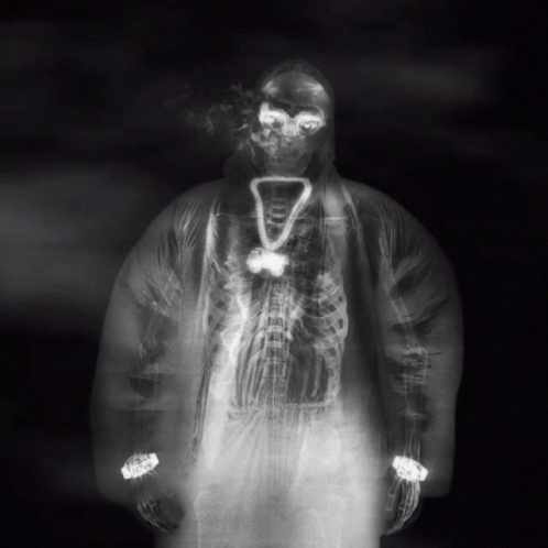 An X-Ray Of A Person With A Necklace That Says 7 GIF