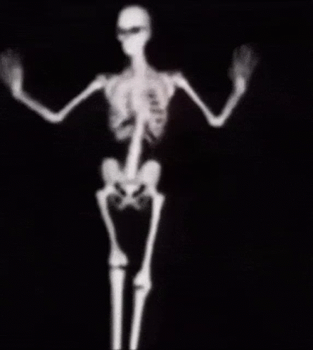 An X-Ray Of A Skeleton Dancing With Its Arms Outstretched . GIF