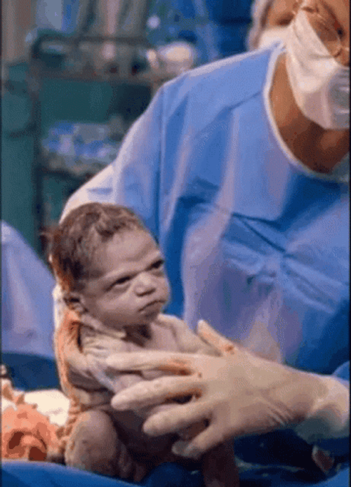 Angry Baby After Birth Meme GIF