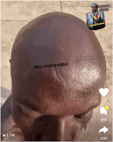 Bald Man Mistachubbz
