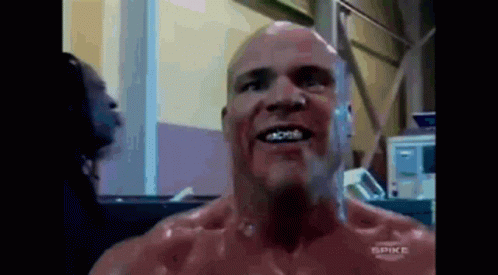 Bald Man With Braces Smiling At Spike Ad GIF