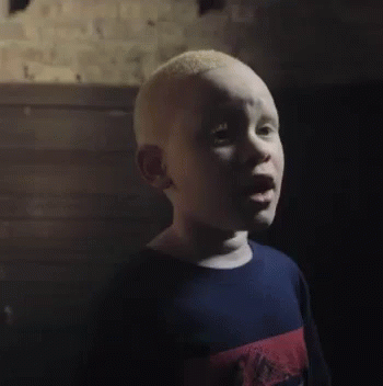 Bald Young Boy Making Funny Face GIF