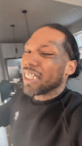 Bearded Man Making Funny Face Eyes Closed Mouth Open