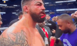 Bearded Man with Bloody Face in Boxing Ring
