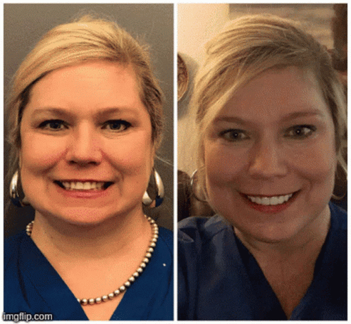 Before and After Woman With Pearl Necklace and Earrings