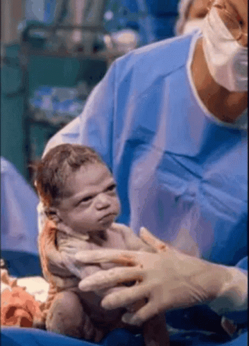 Angry Baby After Birth Meme GIF