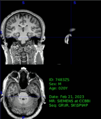 Black and White Brain February 21st 2023