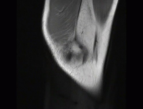Black and White Elbow and Knee