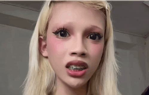 Blonde Girl With Braces Looking at Camera