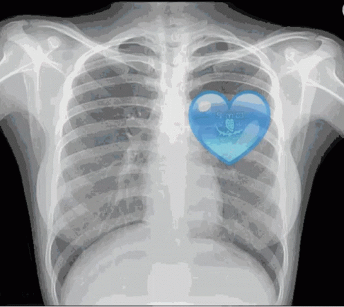 Blue Heart Xray GIF