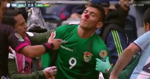 Bolivia Football Player Injured GIF
