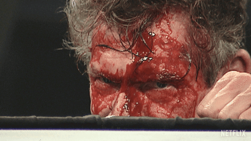 Boxer With Blood On Face In Ring With Netflix Logo GIF