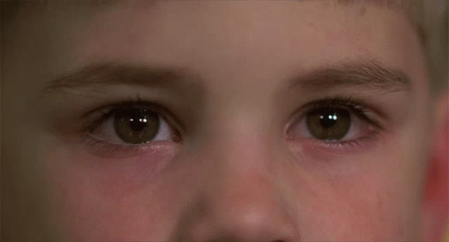 Child's Eyes with Red Eye