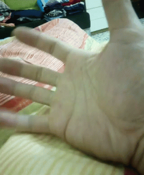 Close Open Hand Exercise GIF