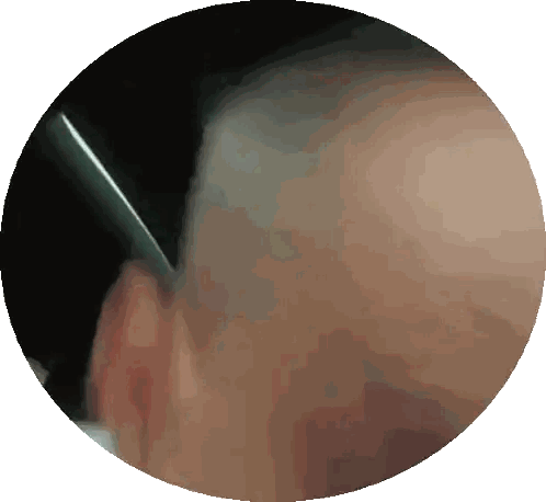 Close Up Ear With Green Object