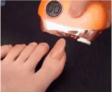 Close Up Feet With Nail Clipper